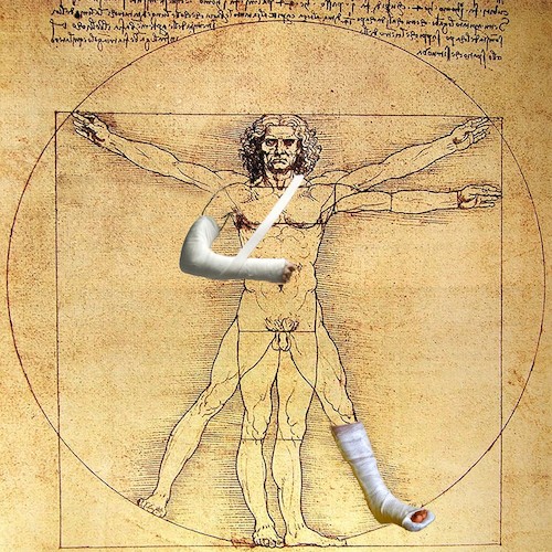 Cartoon: Accident (medium) by zu tagged vitruvian,davinci,accident,gypsum