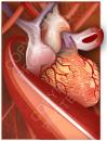 Cartoon: Medical Illustration (small) by remyfrancis tagged medical,heart,vector,drawing,coronary,illustration