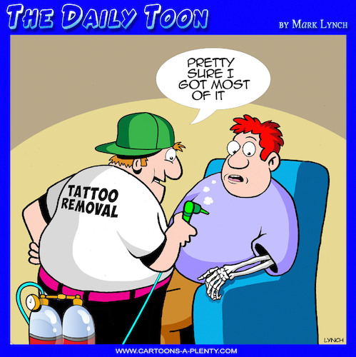 Tattoo removal